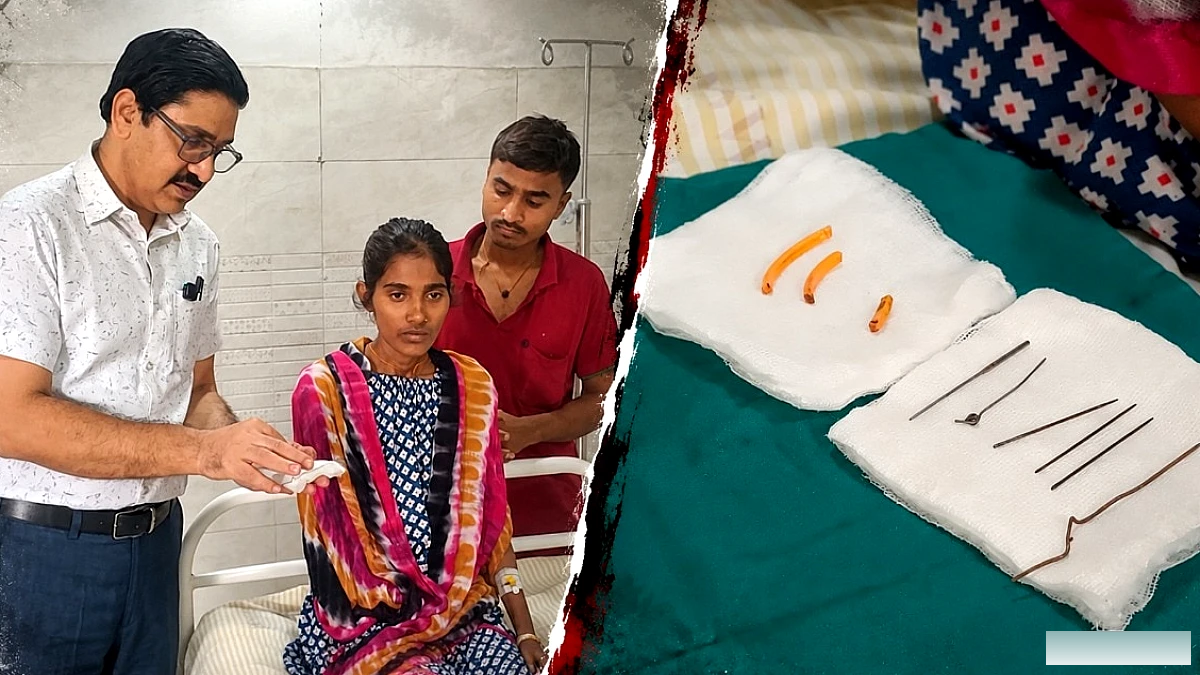 प्रयागराज में Pica रोगी महिला को छह सुई और अन्य नुकीली वस्तुएँ निकाल कर बचाया गया